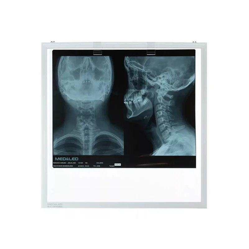 ibspot-36797233